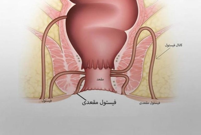 1733744753.775928_762708_image