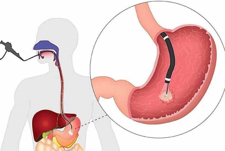 1733744929.309028_951852_image