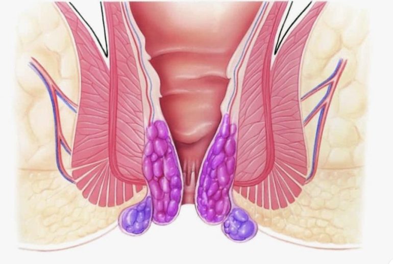 1733744945.334193_266690_image