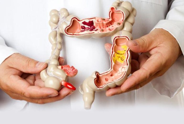 1733744961.040715_542323_image